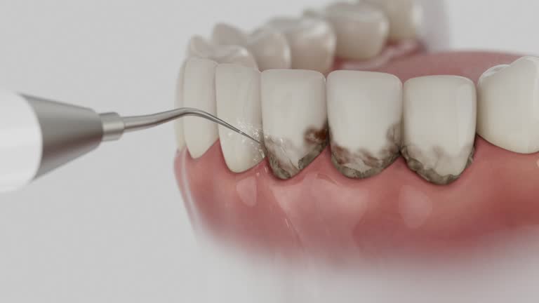 Trusted Dental Crowns And Bridges service in DeQuincy, LA - Dentist Open Now